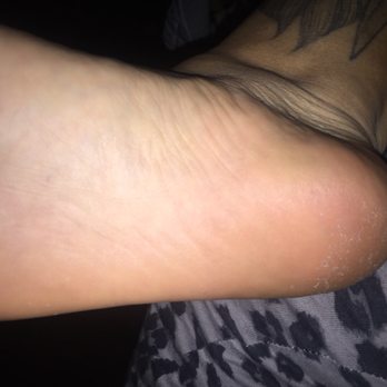 K-Nails - See all the dead skin left still At the bottom of my foot - Nail Salons Near Me - Los Angeles, California