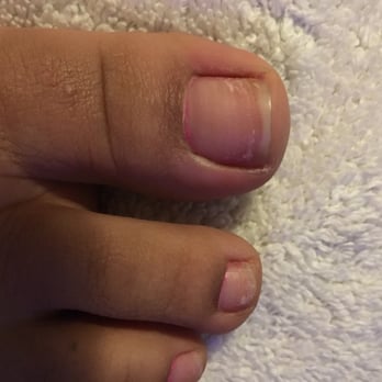 Cudahy Nailspa - After the dr trip - Nail Salons Near Me - Cudahy, California