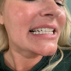 Dental implant crown