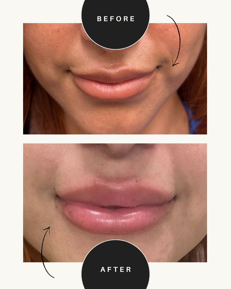 Refined Radiance Logo