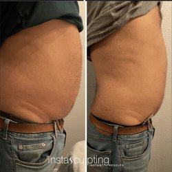 Cryo Republic Wellness and Body Contouring - Our amazing InstaSculpting !!