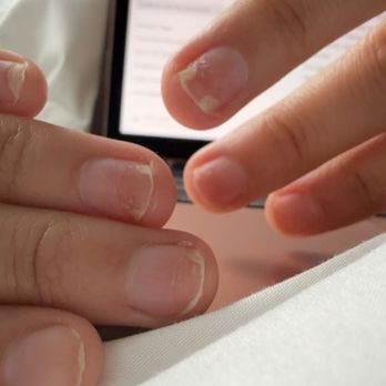 Elegant Nails Salon - My nail destroyed nail beds 2 months later due to this horrible service. - Nail Salons Near Me - East Lansing, Michigan