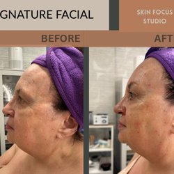 Skin Focus Studio - For all skin types; supporting tone, circulation, cellular energy, and lasting skin health