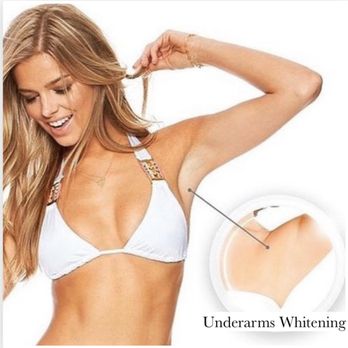 True Laser Spa - Dark spot whitening treatment - Laser Hair Removal Near Me - New York, New York