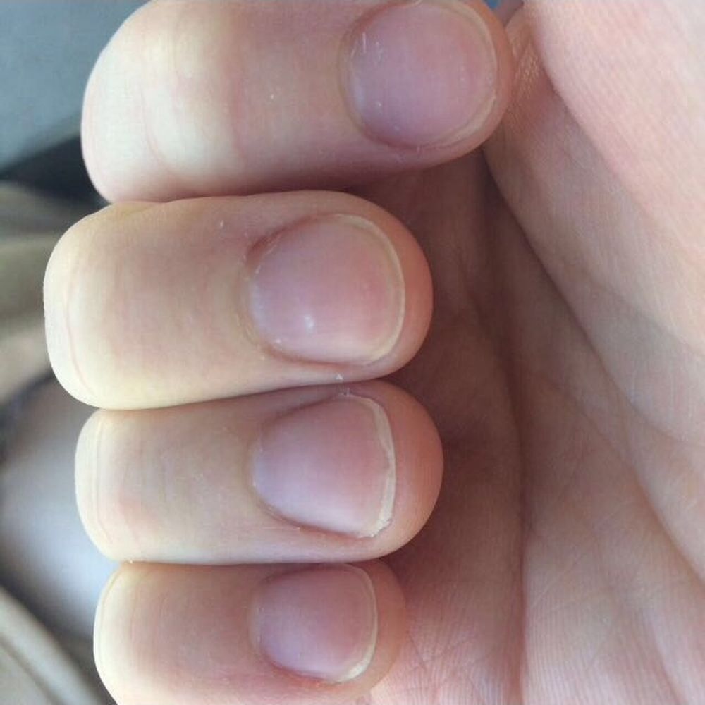 After manicure