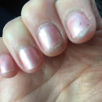 Royal Nail Spa - 1 week and 3 days later. They just keep peeling off!! - Nail Salons Near Me - Glen Ellyn, Illinois Royal Nail Spa - 1 week and 3 days later. They just keep peeling off!! - Nail Salons Near Me - Glen Ellyn, Illinois