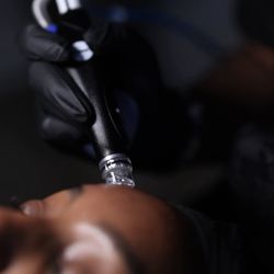 dermani MEDSPA® Preston Hollow - Revitalize your skin with Microdermabrasion. Experience smoother, brighter skin with our expert treatment. Book now!