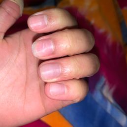 Currently trying to take off the acrylic tips that the manicurist filed down and left on