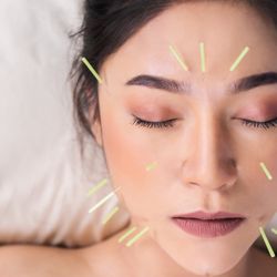 Wellspring Acupuncture - Acupuncture Facial Rejuvenation