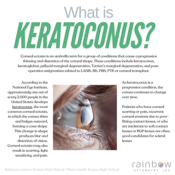 Rainbow Optometry - Learn about Keratoconus! Our doctor specializes in specialty contact lenses. Reach out so we can help you see better. - Optometrists Near Me - Upland, California Rainbow Optometry - Learn about Keratoconus! Our doctor specializes in specialty contact lenses. Reach out so we can help you see better. - Optometrists Near Me - Upland, California