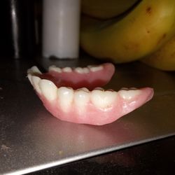 The Dentureman - Teeth stick straight out making it appear as though I have an overbite.