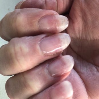T Spa Nails - This is a 40 dollar "dip powder" manicure!!...horrible! - Eyelash Service Near Me - Lakewood, Washington T Spa Nails - This is a 40 dollar "dip powder" manicure!!...horrible! - Eyelash Service Near Me - Lakewood, Washington