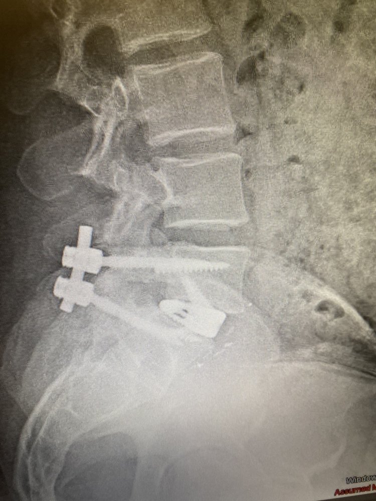 Barrow Brain and Spine - Deer Valley