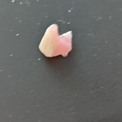 Alamogordo Dental Group - Tooth that broke off denture