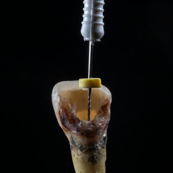 Apex Implant Center - Cosmetic Dentists Near Me - Elk Grove, California