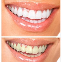 Philip J Weiss, DDS