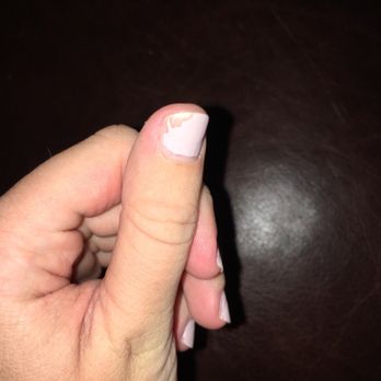 Rose Nails & Spa - **1 day after manicure/pedicure 3 fingers look like this 4 toes 1 toe has no polish - Day Spas Near Me - Canandaigua, New York Rose Nails & Spa - **1 day after manicure/pedicure 3 fingers look like this 4 toes 1 toe has no polish - Day Spas Near Me - Canandaigua, New York
