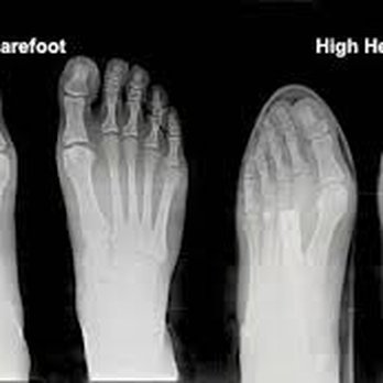 Integrated Muscular Therapy - One are of specialty: Feet - Massage Therapy Near Me - Lexington, Massachusetts