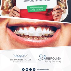 Scarbrough Family Dentistry - We now offer 6 months smiles! We can help you improve that smile before your next cleaning!