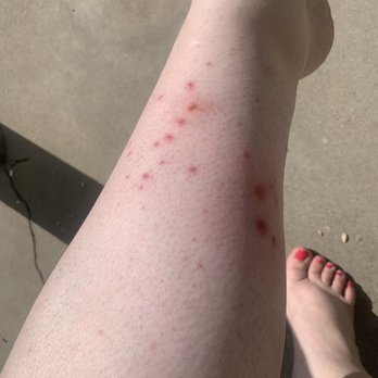 Violette Nails & Spa - Waxed Friday Night. This is left leg Monday Morning. - Nail Salons Near Me - Rowland Heights, California Violette Nails & Spa - Waxed Friday Night. This is left leg Monday Morning. - Nail Salons Near Me - Rowland Heights, California