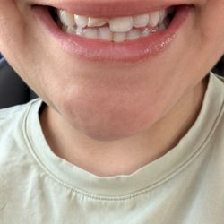 Kaio Dental: Chonway Tram