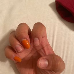 All nails starting to fall off and nail has nail growing on top of my thumb .