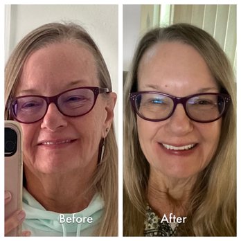 Sarasota Laser Lipo - Weight Loss Centers Near Me - Sarasota, Florida