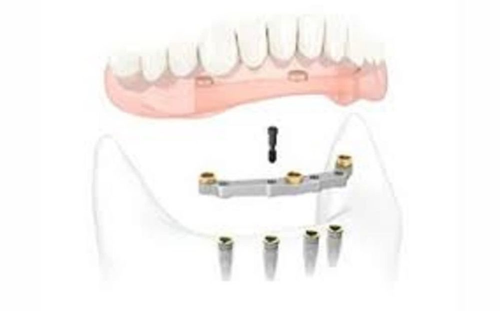 Dentiste Longueuil Chemin Chambly  : Visit The Cibc Banking Location At 1401, Chemin De Chambly, Bureau 105 In Longueuil, Quebec J4J3X6 For Your Everyday Banking.