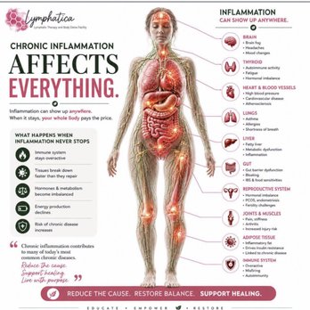 Pawleys Lymphatic Wellness - Inflammation - Massage Therapy Near Me - Murrells Inlet, South Carolina Pawleys Lymphatic Wellness - Inflammation - Massage Therapy Near Me - Murrells Inlet, South Carolina