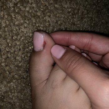 Classy Claws Nail Spa - MESSED UP TOENAIL PART 2! - Nail Salons Near Me - Anaheim, California Classy Claws Nail Spa - MESSED UP TOENAIL PART 2! - Nail Salons Near Me - Anaheim, California