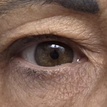 Premier Eye Clinic - Before.. - Ophthalmologists Near Me - Ormond Beach, Florida Premier Eye Clinic - Before.. - Ophthalmologists Near Me - Ormond Beach, Florida
