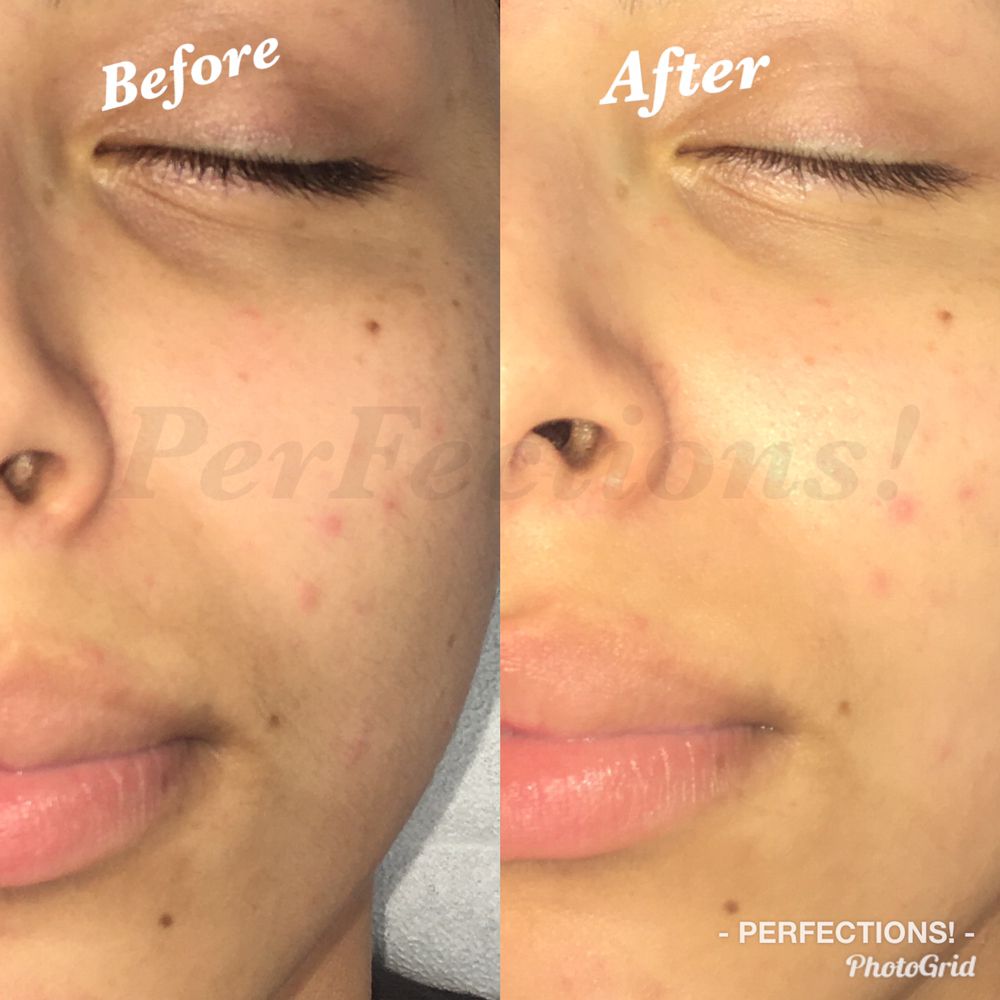 PERFECTIONS HAIR REMOVAL & SKIN CARE 30 Photos 129 S Phelps Ave