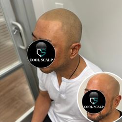 Cool Scalp