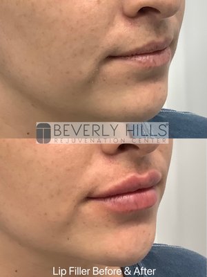 Beverly Hills Rejuvenation Center Westlake Village by null
