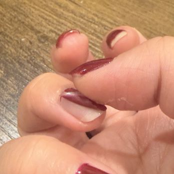 Hug Nails - Gel lifting after less than a day - Nail Technicians Near Me - Brea, California