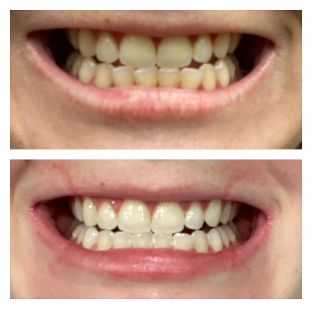 NATURALLY WHITE MEMORIAL 16 Photos & 42 Reviews 12850 Memorial