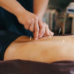Nature Acupuncture & Herb Clinic