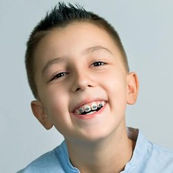 Harmony Orthodontics - Sandy