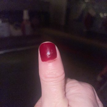 I Love Nail Spa - Cut finger - Nail Salons Near Me - East Meadow, New York I Love Nail Spa - Cut finger - Nail Salons Near Me - East Meadow, New York