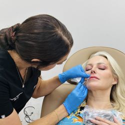 PA Taylor Waldrum finishing Baby Lip Filler treatment