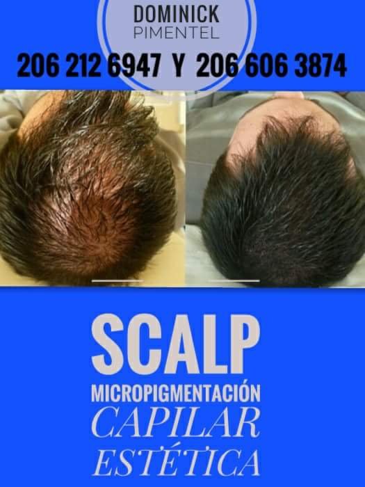 SCALP Clínic Pimentel Logo