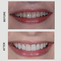 L. Andrew Mutch, DDS