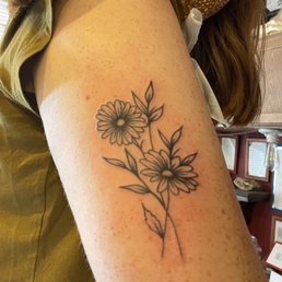Back of the upper arm right afterwards Back of the upper arm right afterwards
