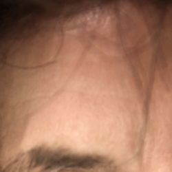 Cosmetic Surgery & Laser Centers of El Paso - My eyebrows took a downturn!  Terrible