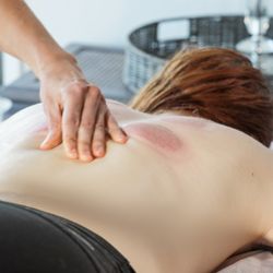 Ganit Wellness - Cupping in Pacific Palisades.