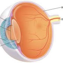 Stein, Peter J O.D.-Eyeworks CT