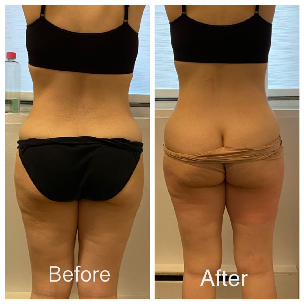 FACE AND BODY BY RUNCHANA MEDSPA Updated September 2024 30 Photos & 25 Reviews 10 W 56th