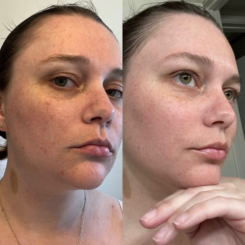 Serenity Skin Spa - Microdermabrasion, light peel, and LED light therapy - Skin Care Near Me - Newport Beach, California Serenity Skin Spa - Microdermabrasion, light peel, and LED light therapy - Skin Care Near Me - Newport Beach, California