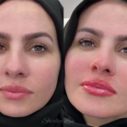 Shirleypmu Esthetics