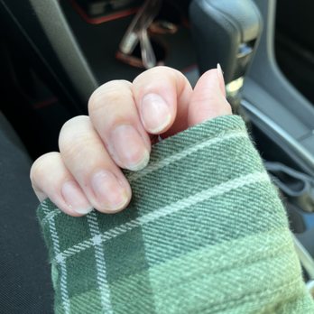 Lecheta Nail Bar - On my right hand you can also see the fungal infection on my ring finger. - Nail Salons Near Me - Bellflower, California Lecheta Nail Bar - On my right hand you can also see the fungal infection on my ring finger. - Nail Salons Near Me - Bellflower, California